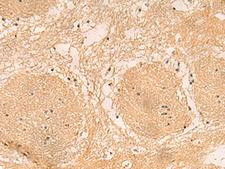 EMC1 Antibody - Immunohistochemistry of paraffin-embedded Human brain tissue  using EMC1 Polyclonal Antibody at dilution of 1:40(×200)