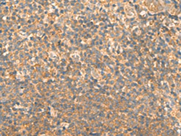 EMC1 Antibody - Immunohistochemistry of paraffin-embedded Human tonsil tissue  using EMC1 Polyclonal Antibody at dilution of 1:40(×200)
