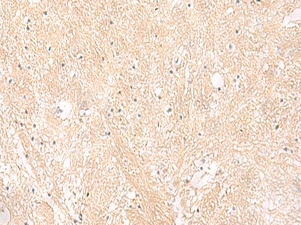EMC1 Antibody - Immunohistochemistry of paraffin-embedded Human brain tissue  using EMC1 Polyclonal Antibody at dilution of 1:35(×200)