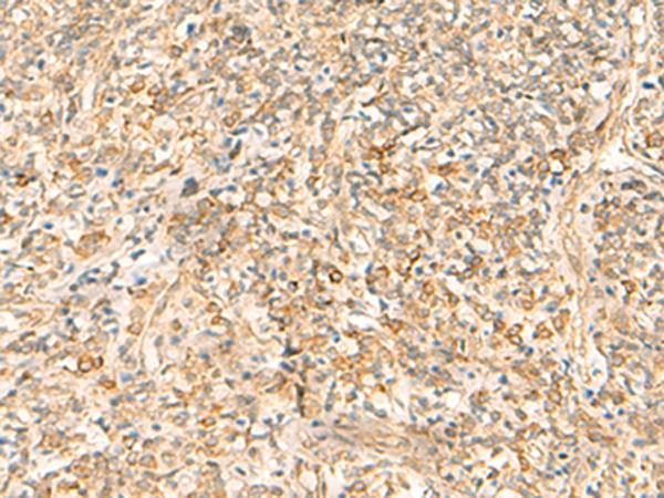 EMC1 Antibody - Immunohistochemistry of paraffin-embedded Human tonsil tissue  using EMC1 Polyclonal Antibody at dilution of 1:35(×200)