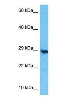 EMC10 Antibody - Western blot of EMC10 Antibody with human THP-1 Whole Cell lysate.  This image was taken for the unconjugated form of this product. Other forms have not been tested.