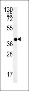 EMC3 Antibody - TM111 Antibody western blot of MDA-MB435 cell line lysates (35 ug/lane). The TM111 antibody detected the TM111 protein (arrow).