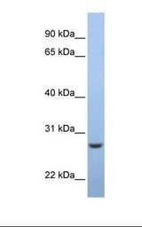 EMC7 Antibody - Fetal muscle lysate. Antibody concentration: 1.0 ug/ml. Gel concentration: 12%.  This image was taken for the unconjugated form of this product. Other forms have not been tested.