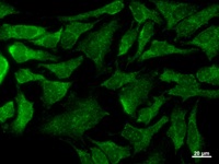 EMC8 / COX4NB Antibody - Immunostaining analysis in HeLa cells. HeLa cells were fixed with 4% paraformaldehyde and permeabilized with 0.1% Triton X-100 in PBS. The cells were immunostained with anti-COX4NB mAb.