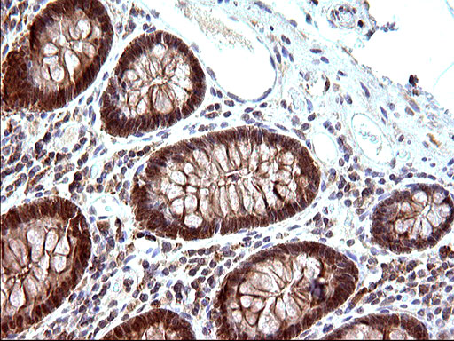 EMC8 / COX4NB Antibody - IHC of paraffin-embedded Human colon tissue using anti-COX4NB mouse monoclonal antibody. (Heat-induced epitope retrieval by 10mM citric buffer, pH6.0, 120°C for 3min).
