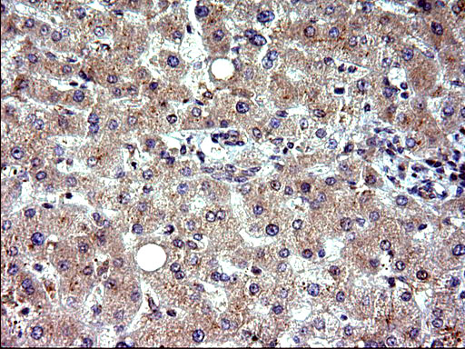 EMC8 / COX4NB Antibody - IHC of paraffin-embedded Human liver tissue using anti-COX4NB mouse monoclonal antibody. (Heat-induced epitope retrieval by 10mM citric buffer, pH6.0, 120°C for 3min).