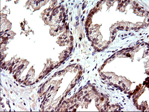 EMC8 / COX4NB Antibody - IHC of paraffin-embedded Human prostate tissue using anti-COX4NB mouse monoclonal antibody. (Heat-induced epitope retrieval by 10mM citric buffer, pH6.0, 120°C for 3min).