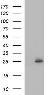 EMC8 / COX4NB Antibody - HEK293T cells were transfected with the pCMV6-ENTRY control (Left lane) or pCMV6-ENTRY COX4NB (Right lane) cDNA for 48 hrs and lysed. Equivalent amounts of cell lysates (5 ug per lane) were separated by SDS-PAGE and immunoblotted with anti-COX4NB.