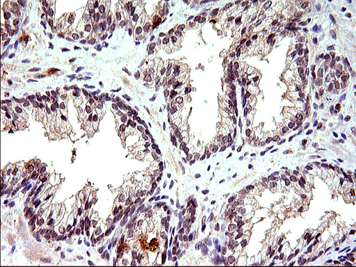 EMC8 / COX4NB Antibody - IHC of paraffin-embedded Human prostate tissue using anti-COX4NB mouse monoclonal antibody. (Heat-induced epitope retrieval by 10mM citric buffer, pH6.0, 120°C for 3min).