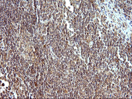 EMC8 / COX4NB Antibody - IHC of paraffin-embedded Human lymphoma tissue using anti-COX4NB mouse monoclonal antibody. (Heat-induced epitope retrieval by 10mM citric buffer, pH6.0, 120°C for 3min).