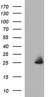 EMC8 / COX4NB Antibody - HEK293T cells were transfected with the pCMV6-ENTRY control (Left lane) or pCMV6-ENTRY COX4NB (Right lane) cDNA for 48 hrs and lysed. Equivalent amounts of cell lysates (5 ug per lane) were separated by SDS-PAGE and immunoblotted with anti-COX4NB.
