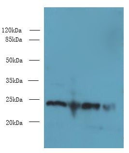 EMC8 / COX4NB Antibody - Western blot. All lanes: EMC8 antibody at 0.8 ug/ml. Lane 1: A549 whole cell lysate. Lane 2: Human placenta tissue. Lane 3: HeLa whole cell lysate. Lane 4: HT29 whole cell lysate. Secondary Goat polyclonal to Rabbit IgG at 1:10000 dilution. Predicted band size: 24 kDa. Observed band size: 24 kDa.
