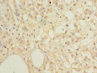 EMC8 / COX4NB Antibody - Immunohistochemistry of paraffin-embedded human adrenal gland tissue using antibody at dilution of 1:100.