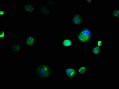 EMC8 / COX4NB Antibody - Immunofluorescence staining of MCF-7 cells with EMC8 Antibody at 1:133, counter-stained with DAPI. The cells were fixed in 4% formaldehyde, permeabilized using 0.2% Triton X-100 and blocked in 10% normal Goat Serum. The cells were then incubated with the antibody overnight at 4°C. The secondary antibody was Alexa Fluor 488-congugated AffiniPure Goat Anti-Rabbit IgG(H+L).