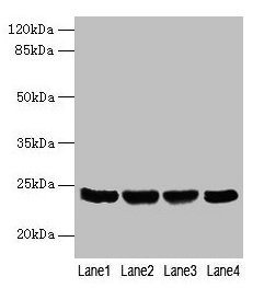 EMC8 / COX4NB Antibody - Western blot All lanes: EMC8 antibody at 0.8µg/ml Lane 1: A549 whole cell lysate Lane 2: Human placenta tissue Lane 3: Hela whole cell lysate Lane 4: HT29 whole cell lysate Secondary Goat polyclonal to rabbit IgG at 1/10000 dilution Predicted band size: 24, 14 kDa Observed band size: 24 kDa