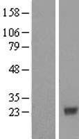 EMC8 / COX4NB Protein - Western validation with an anti-DDK antibody * L: Control HEK293 lysate R: Over-expression lysate
