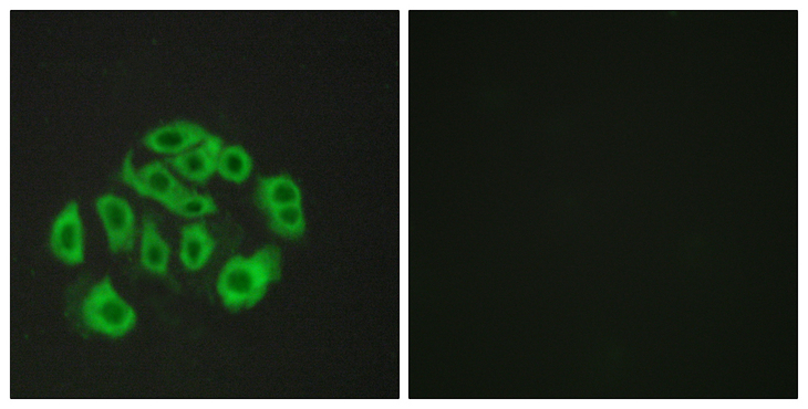 EMCN / Endomucin Antibody - Immunofluorescence analysis of HepG2 cells, using Mucin-14 Antibody. The picture on the right is blocked with the synthesized peptide.