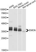 EMCN / Endomucin Antibody - Western blot analysis of extracts of various cell lines, using EMCN antibody at 1:1000 dilution. The secondary antibody used was an HRP Goat Anti-Rabbit IgG (H+L) at 1:10000 dilution. Lysates were loaded 25ug per lane and 3% nonfat dry milk in TBST was used for blocking. An ECL Kit was used for detection and the exposure time was 1s.