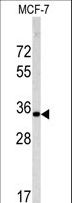 EMD / Emerin Antibody - Western blot of EMD antibody in MCF-7 cell line lysates (35 ug/lane). EMD (arrow) was detected using the purified antibody.