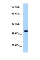 EMD / Emerin Antibody - EMD / Emerin antibody Western blot of MCF7 Cell lysate. Antibody concentration 1 ug/ml.  This image was taken for the unconjugated form of this product. Other forms have not been tested.