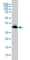 EMD / Emerin Antibody - Western blot of EMD expression in HeLa cell lysate.