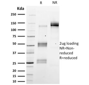 EMD / Emerin Antibody - SDS-PAGE analysis of purified, BSA-free Emerin antibody (clone EMD/2167) as confirmation of integrity and purity.