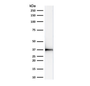EMD / Emerin Antibody - Western blot testing of human HeLa cell lysate with Emerin antibody (clone EMD/2168). Expected molecular weight: 29-34 kDa.