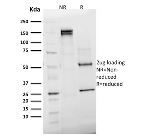 EMD / Emerin Antibody - SDS-PAGE analysis of purified, BSA-free Emerin antibody (clone EMD/2168) as confirmation of integrity and purity.