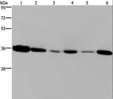 EMD / Emerin Antibody - Western blot analysis of 293T and MCF-7 cell, human hepatocellular carcinoma tissue and Raji cell, A431 and A549 cell, using EMD Polyclonal Antibody at dilution of 1:1200.
