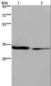 EMD / Emerin Antibody - Western blot analysis of 293T and A549 cell, using EMD Polyclonal Antibody at dilution of 1:1600.