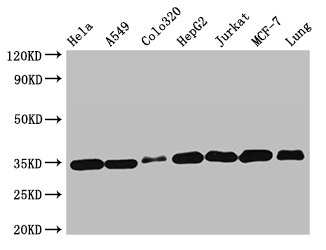 EMD / Emerin Antibody - Positive WB detected in:Hela whole cell lysate,A549 whole cell lysate,Colo320 whole cell lysate,HepG2 whole cell lysate,Jurkat whole cell lysate,MCF-7 whole cell lysate,Mouse lung tissue;All lanes:EMD antibody at 2?g/ml;Secondary;Goat polyclonal to rabbit IgG at 1/50000 dilution;Predicted band size: 29 KDa;Observed band size: 35 KDa;