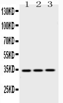 EMD / Emerin Antibody - Western blot - Anti-Emerin Picoband Antibody