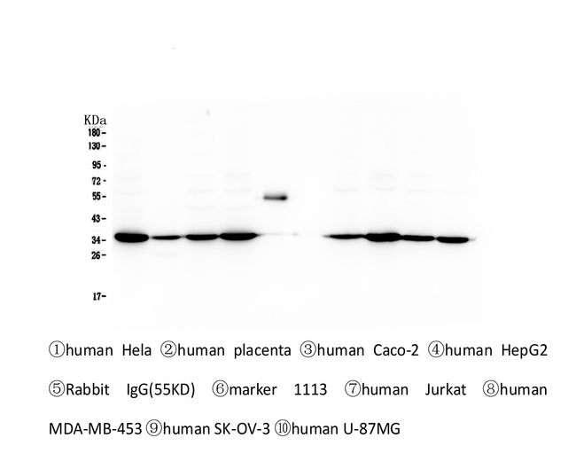 EMD / Emerin Antibody - Western blot analysis of Emerin using anti-Emerin antibody. Electrophoresis was performed on a 5-20% SDS-PAGE gel at 70V (Stacking gel) / 90V (Resolving gel) for 2-3 hours. The sample well of each lane was loaded with 50ug of sample under reducing conditions. Lane 1: human Hela whole cell lysates, Lane 2: human placenta tissue lysates, Lane 3: human Caco-2 whole cell lysates, Lane 4: human HepG2 whole cell lysates,Lane 5: Rabbit IgG, Lane 6: Marker 1113, Lane 7: human Jurkat whole cell lysates. Lane 8: human MDA-MB-453 whole cell lysates, Lane 9: human SK-OV-3 whole cell lysates, Lane 10: human SW620 whole cell lysates. After Electrophoresis, proteins were transferred to a Nitrocellulose membrane at 150mA for 50-90 minutes. Blocked the membrane with 5% Non-fat Milk/ TBS for 1.5 hour at RT. The membrane was incubated with mouse anti-Emerin antigen affinity purified monoclonal antibody at 0.5 µg/mL overnight at 4°C, then washed with TBS-0.1% Tween 3 times with 5 minutes each and probed with a Biotin Conjugated goat anti-mouse IgG secondary antibody at a dilution of 1:10000 for 1.5 hour at RT. The signal is developed using an Enhanced Chemiluminescent detection (ECL) kit with Tanon 5200 system.
