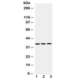 EMD / Emerin Antibody - Western blot testing of 1) rat skeletal muscle, 2) mouse heart and 3) human HeLa lysate with Emerin antibody at 0.5ug/ml. Predicted molecular weight 29 kDa but routinely observed at ~34 kDa.