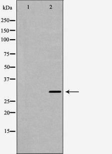 EMD / Emerin Antibody - Western blot analysis of HeLa whole cells lysates using EMD antibody. The lane on the left is treated with the antigen-specific peptide.