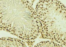 EMD / Emerin Antibody - 1:100 staining mouse testis tissue by IHC-P. The sample was formaldehyde fixed and a heat mediated antigen retrieval step in citrate buffer was performed. The sample was then blocked and incubated with the antibody for 1.5 hours at 22°C. An HRP conjugated goat anti-rabbit antibody was used as the secondary.