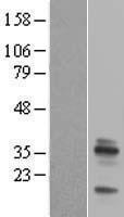 EMD / Emerin Protein - Western validation with an anti-DDK antibody * L: Control HEK293 lysate R: Over-expression lysate
