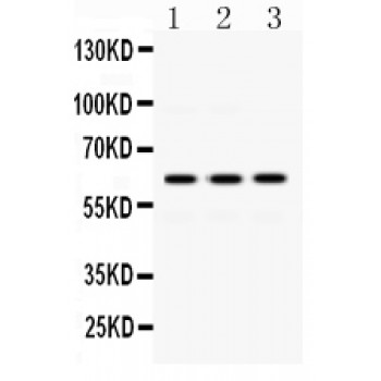 EME1 Antibody - EME1 antibody Western blot. All lanes: Anti EME1 at 0.5 ug/ml. Lane 1: HELA Whole Cell Lysate at 40 ug. Lane 2: JURKAT Whole Cell Lysate at 40 ug. Lane 3: HUT Whole Cell Lysate at 40 ug. Predicted band size: 62 kD. Observed band size: 62 kD.
