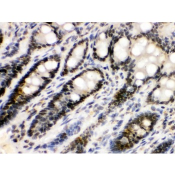 EME1 Antibody - EME1 antibody IHC-paraffin. IHC(P): Rat Intestine Tissue.
