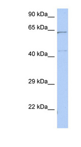 EME1 Antibody - EME1 antibody Western blot of HT1080 cell lysate. This image was taken for the unconjugated form of this product. Other forms have not been tested.