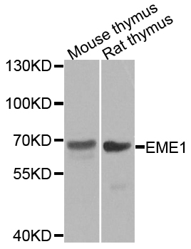 EME1 Antibody - Western blot analysis of extracts of various tissues.