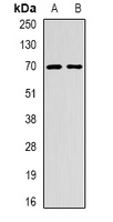 EME1 Antibody - Western blot analysis of EME1 expression in mouse thymus (A); rat thymus (B) whole cell lysates.