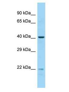 EME2 Antibody - EME2 antibody Western Blot of MCF7. Antibody dilution: 1 ug/ml.  This image was taken for the unconjugated form of this product. Other forms have not been tested.