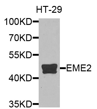 EME2 Antibody - Western blot analysis of extracts of HT-29 cells.