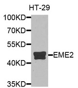 EME2 Antibody - Western blot analysis of extracts of HT-29 cells.