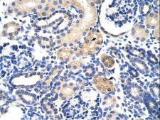 EMG1 / NEP1 Antibody - EMG1 antibody ARP40636_P050-NP_006322-EMG1 (EMG1 nucleolar protein homolog (S. cerevisiae)) Antibody was used in IHC to stain formalin-fixed, paraffin-embedded human kidney.  This image was taken for the unconjugated form of this product. Other forms have not been tested.