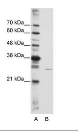 EMG1 / NEP1 Antibody - A: Marker, B: HepG2 Cell Lysate.  This image was taken for the unconjugated form of this product. Other forms have not been tested.