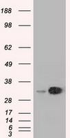 EMG1 / NEP1 Antibody - HEK293T cells were transfected with the pCMV6-ENTRY control (Left lane) or pCMV6-ENTRY EMG1 (Right lane) cDNA for 48 hrs and lysed. Equivalent amounts of cell lysates (5 ug per lane) were separated by SDS-PAGE and immunoblotted with anti-EMG1.
