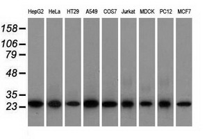 EMG1 / NEP1 Antibody - Western blot analysis of extracts (35ug) from 9 different cell lines by using anti-EMG1 monoclonal antibody.
