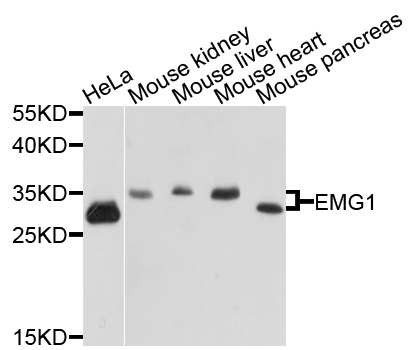 EMG1 / NEP1 Antibody - Western blot analysis of extracts of various cells.